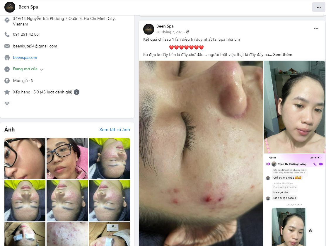 Been Spa Quận 5